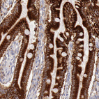 Immunohistochemical staining of human duodenum shows strong cytoplasmic positivity in glandular cells.