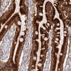 Immunohistochemical staining of human duodenum shows strong cytoplasmic positivity in glandular cells.