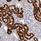 Immunohistochemical staining of human kidney shows strong cytoplasmic positivity in cells in proximal tubules.