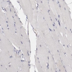 Immunohistochemical staining of human skeletal muscle shows no positivity in myocytes as expected.
