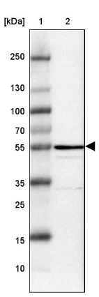 Lane 1: Marker [kDa] 250, 130, 100, 70, 55, 35, 25, 15, 10_br/_Lane 2: Human Liver tissue