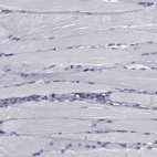 Immunohistochemical staining of human skeletal muscle shows no positivity in myocytes as expected.