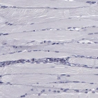 Immunohistochemical staining of human skeletal muscle shows no positivity in myocytes as expected.