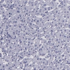 Immunohistochemical staining of human liver shows no positivity in hepatocytes as expected.