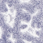 Immunohistochemical staining of human prostate shows no positivity in cells in seminiferous ducts as expected.