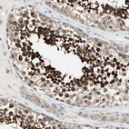 Anti-CGRRF1 Antibody