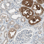 Anti-CGRRF1 Antibody