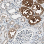 Immunohistochemical staining of human kidney shows strong cytoplasmic positivity in cells in tubules.