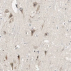 Immunohistochemical staining of human cerebral cortex shows weak cytoplasmic positivity in neurons.