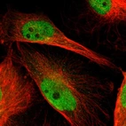 Immunofluorescent staining of human cell line U-251 MG shows localization to nucleoplasm.