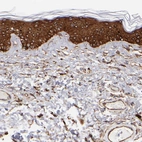 Immunohistochemical staining of human skin shows strong cytoplasmic positivity in squamous epithelial cells.