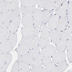 Anti-AHNAK2 Antibody