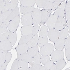 Immunohistochemical staining of human skeletal muscle shows no positivity in myocytes as expected.
