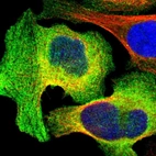 Immunofluorescent staining of human cell line U-2 OS shows localization to plasma membrane & cytosol.