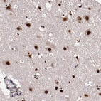 Anti-CECR2 Antibody