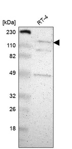 Western blot analysis in human cell line RT-4.