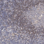 Immunohistochemical staining of human lymphoid tissues shows moderate cytoplasmic positivity in non - germinal center cells.