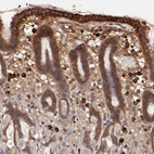 Anti-SRRD Antibody