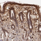 Immunohistochemical staining of human stomach shows moderate to strong cytoplasmic positivity in glandular cells.