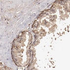 Immunohistochemical staining of human prostate shows weak to moderate cytoplasmic/membranous positivity in glandular cells.