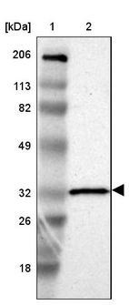 Lane 1: Marker [kDa] 206, 113, 82, 49, 32, 26, 18_br/_Lane 2: Human cell line RT-4