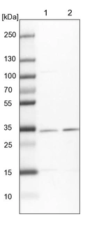 Lane 1: NIH-3T3 cell lysate (Mouse embryonic fibroblast cells)_br/_Lane 2: NBT-II cell lysate (Rat Wistar bladder tumour cells)