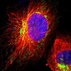 Immunofluorescent staining of human cell line U-251 MG shows localization to mitochondria.
