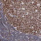 Immunohistochemical staining of human lymph node shows high expression.