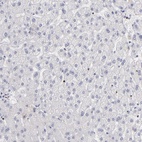 Immunohistochemical staining of human liver shows low expression as expected.