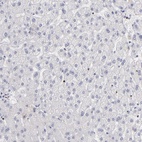 Anti-POLA1 Antibody