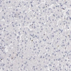 Immunohistochemical staining of human liver shows low expression as expected.