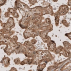 Immunohistochemical staining of human placenta shows moderate membranous and cytoplasmic positivity in trophoblast.