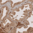 Immunohistochemical staining of human prostate shows moderate membranous and cytoplasmic positivity in glandular cells.
