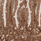 Immunohistochemical staining of human duodenum shows moderate membranous and cytoplasmic positivity in glandular cells.