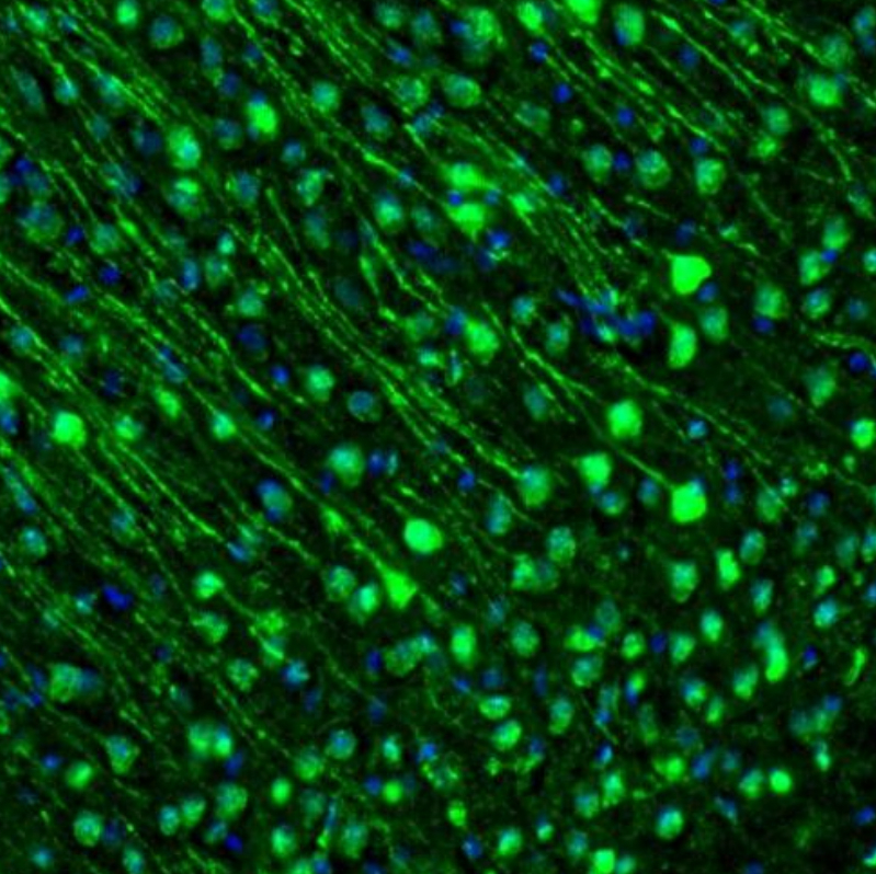 Anti-GMFB Antibody
