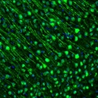 Anti-GMFB Antibody