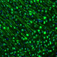 Anti-GMFB Antibody