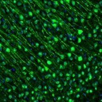 Anti-GMFB Antibody
