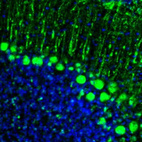 Anti-GMFB Antibody