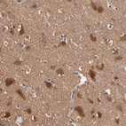 Immunohistochemical staining of human cerebral cortex shows moderate cytoplasmic positivity in neurons.