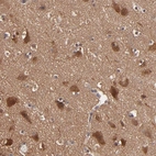 Immunohistochemical staining of human cerebral cortex shows moderate cytoplasmic positivity in neurons.