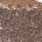 Immunohistochemical staining of human cerebellum shows moderate cytoplasmic positivity in Purkinje cells.