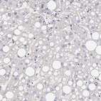 Immunohistochemical staining of human liver shows no cytoplasmic positivity in hepatocytes as expected.