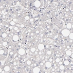 Immunohistochemical staining of human liver shows no cytoplasmic positivity in hepatocytes as expected.