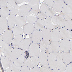 Immunohistochemical staining of human skeletal muscle shows no cytoplasmic positivity in myocytes as expected.