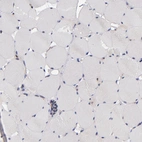 Immunohistochemical staining of human skeletal muscle shows no cytoplasmic positivity in myocytes as expected.