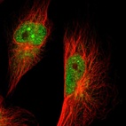 Immunofluorescent staining of human cell line U-251 MG shows localization to nucleoplasm, nuclear bodies & cytosol.