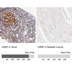 Anti-LRMP Antibody