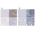 Immunohistochemical staining of human liver, lymphoid tissues, skeletal muscle and upper gastrointestinal using Anti-LRMP antibody HPA002967 (A) shows similar protein distribution across tissues to independent antibody HPA018505 (B).