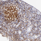 Immunohistochemical staining of human tonsil shows strong membranous positivity in germinal center cells.